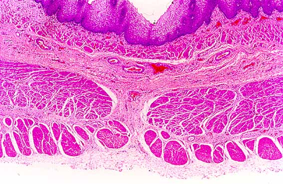 fig. 2b