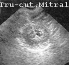 57MITRAL.JPG (10693 bytes)