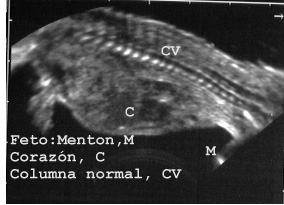 71FETOCV.JPG (23851 bytes)