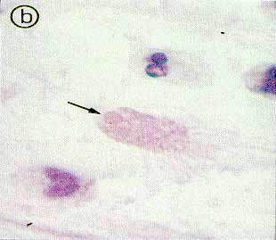 fig. 1b