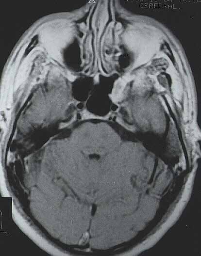 fig. 11