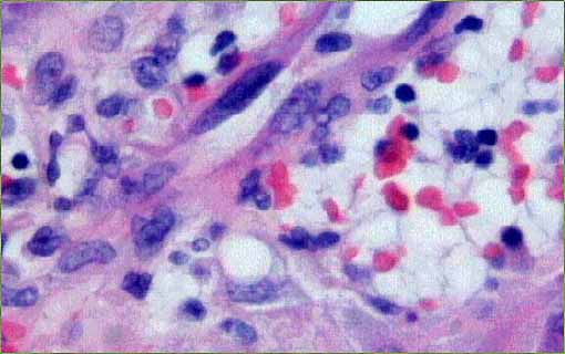 fig. 15