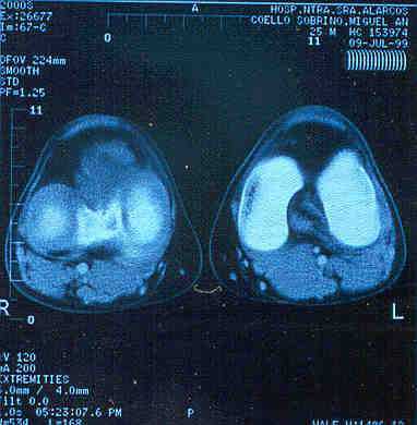 Fig.1