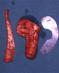 fig.1