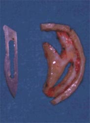 fig.2