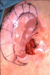 fig.3
