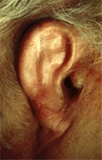 fig.6