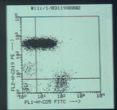 mzl4.jpg (23724 bytes)