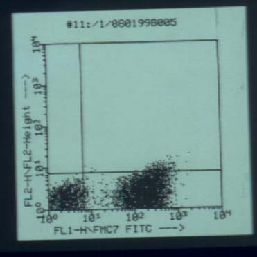 mzl5.jpg (19533 bytes)