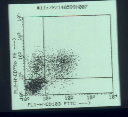 mzl6.jpg (26130 bytes)