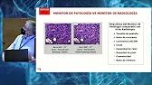 Vdeo La importancia del monitor en diagnstico en patologa digital