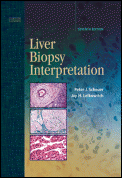 Liver Biopsy Interpretation, 7th edition
