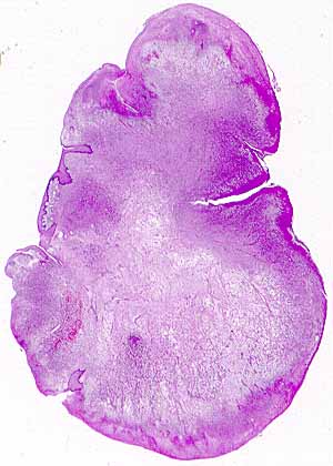 caso16.jpg (23956 bytes)